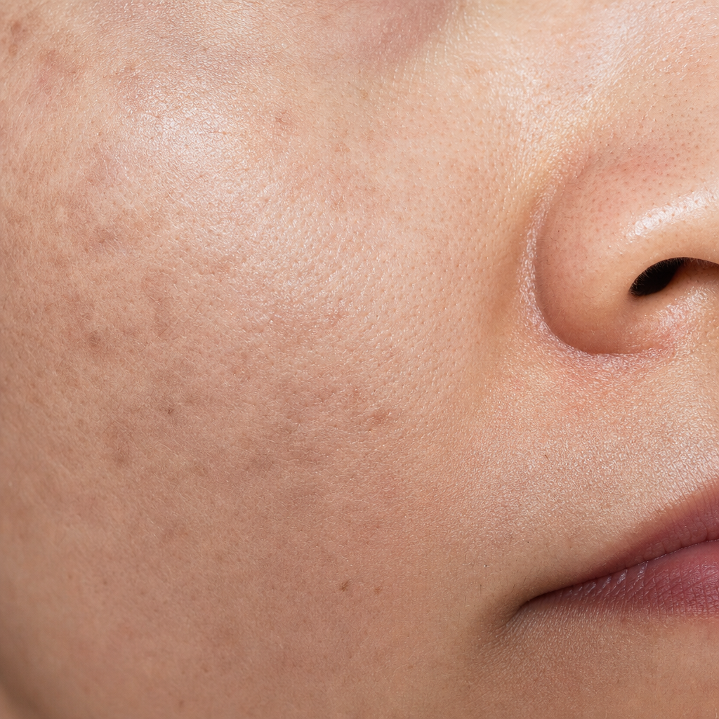 Close-up of uneven skin tone